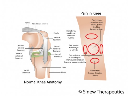 What is a common reason for a torn knee ligament?